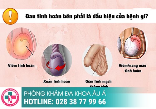 Đau tức dái là bị gì? 