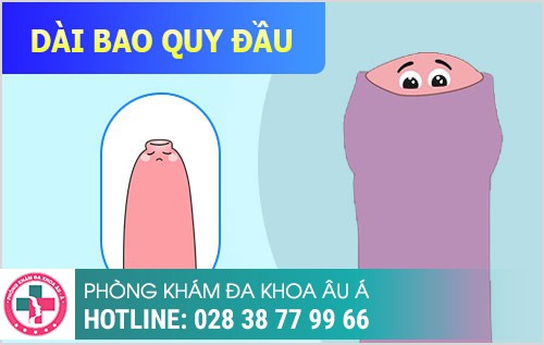 HÌNH ẢNH BỆNH NGOẠI KHOA NAM THƯỜNG GẶP