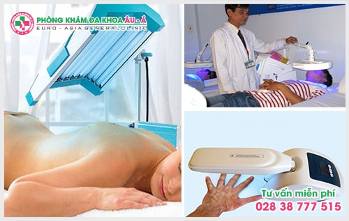 Bệnh bạch biến có nguy hiểm không?