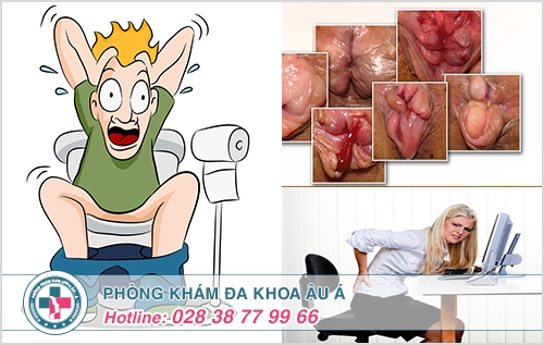 Bệnh trĩ nội trĩ ngoại có nguy hiểm không?