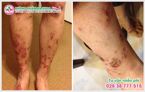 Vậy bệnh viện bệnh ngứa TPHCM nằm ở đâu? Đây chính là mối quan tâm  của rất nhiều người bệnh.