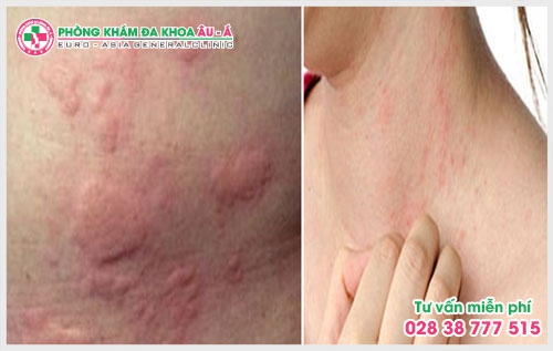 Để biết cách trị bệnh ngứa ngoài da nào phù hợp thì theo lời khuyên của các bác sĩ bệnh nhân nên tìm đến những phòng khám chuyên khoa để được tư vấn