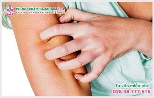 Để biết cách trị bệnh ngứa ngoài da nào phù hợp thì theo lời khuyên của các bác sĩ bệnh nhân nên tìm đến những phòng khám chuyên khoa để được tư vấn