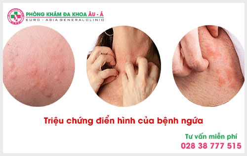 Thế nhưng chi phí xét nghiệm bệnh ngứa hết bao nhiêu? Chính là mối quan tâm  của rất nhiều người bệnh.