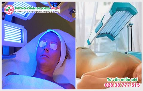 Dấu hiệu triệu chứng của bệnh bạch biến