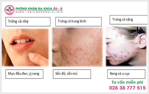 Chính vì thế mà việc tìm một địa chỉ chữa bệnh mụn trứng cá ở TPHCM là điều mà nhiều chị em, phụ nữ quan tâm hiện nay.