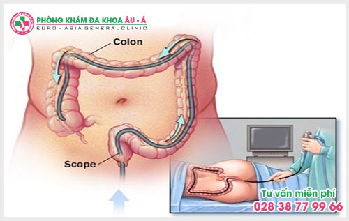 Máy soi hậu môn trực tràng Dr Camscope là một bước vô cùng quan trọng trong việc thăm khám, xác định bệnh lý cụ thể cũng như mức độ tình trạng bệnh.