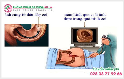 Máy soi hậu môn trực tràng Dr Camscope là một bước vô cùng quan trọng trong việc thăm khám, xác định bệnh lý cụ thể cũng như mức độ tình trạng bệnh.