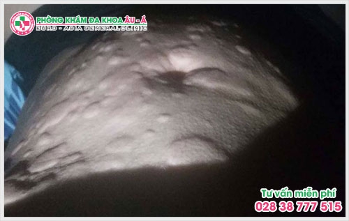 Các loại thuốc chữa bệnh ngứa khắp người  là thuốc bôi và thuốc uống, các loại này có tác dụng tiêu diệt các mầm móng gây bệnh