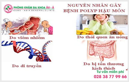 Khi bị polyp hậu môn trực tràng nên làm gì? Đây chính là câu hỏi thắc mắc của rất nhiều người bệnh trong số đó có bạn Nhật Huy đã gởi tâm sự của mình về chuyên mục tư vấn bệnh hậu môn trực tràng tại phòng khám Đa Khoa Âu Á. 