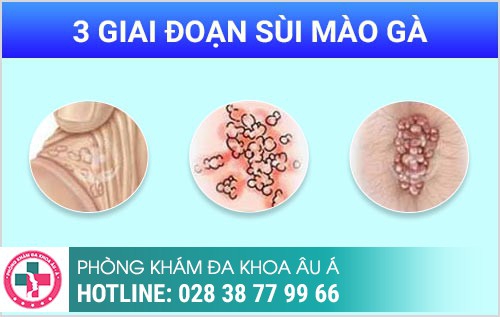 HÌNH ẢNH BỆNH NGOẠI KHOA NAM THƯỜNG GẶP