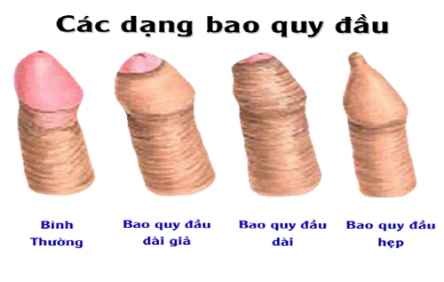 tuột bao quy đầu