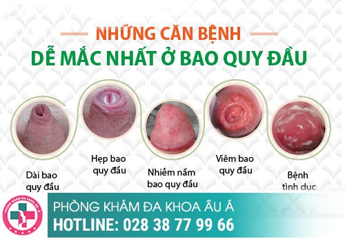 Nguyên nhân bị rách da ở vùng kín nam là gì?