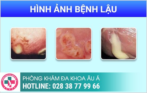 HÌNH ẢNH BỆNH NGOẠI KHOA NAM THƯỜNG GẶP