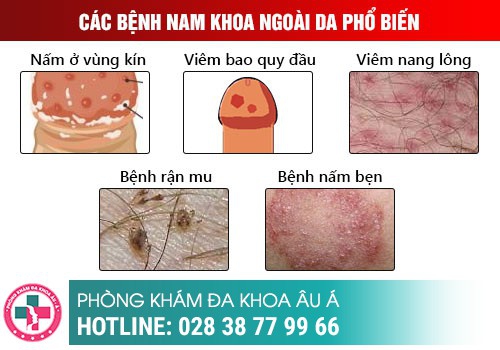 Bộ phận sinh dục nam bị rát đỏ là bị gì?