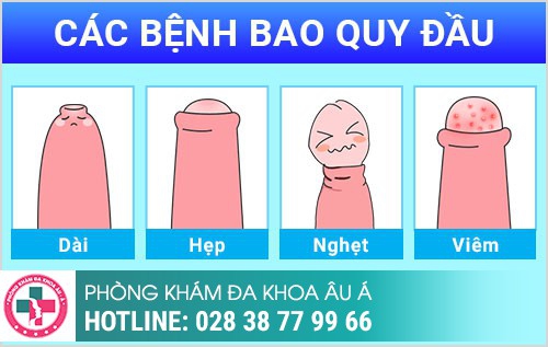 Bệnh ngoại khoa nam thường gặp
