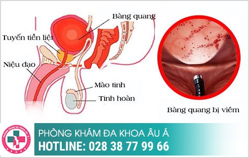 Bệnh ngoại khoa nam thường gặp