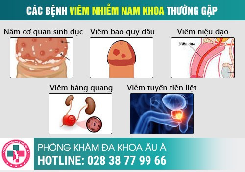 Viêm nhiễm nam khoa gây nguy hiểm gì?