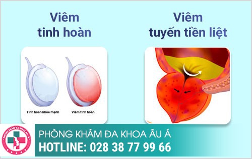 bệnh viêm nhiễm ngoại khoa nam giới