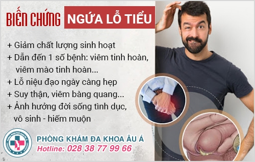 Ngứa lỗ tiểu, ngứa ống dẫn đường tiểu ở nam