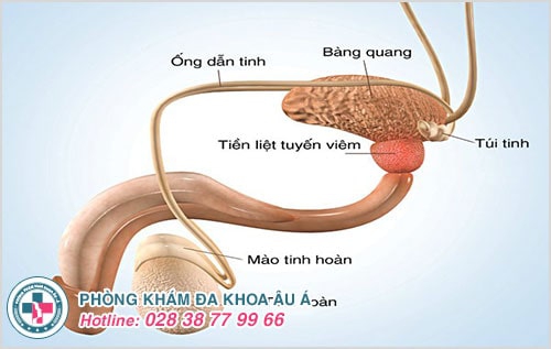 viêm tuyến tiền liệt