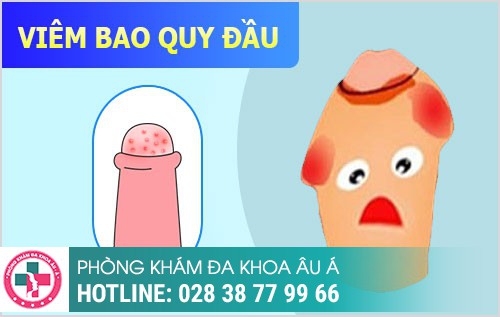 Bợn trắng bao quy đầu