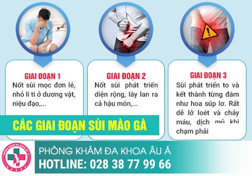 Nổi mụn li ti ở dương vật