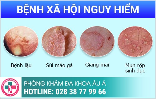 Các bệnh ngoại khoa nam Thường Gặp