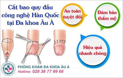 cắt bao quy đầu
