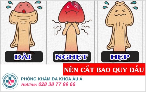 cắt bao quy đầu uy tín