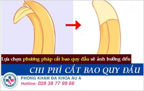 chi phí cắt bao quy đầu