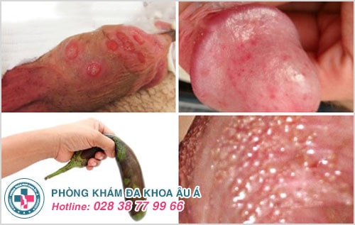 chữa yếu sinh lý tại nhà