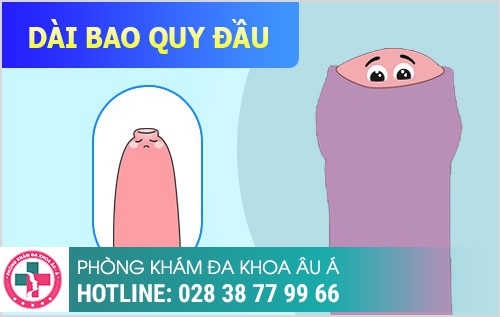 Dài Bao Quy Đầu Có Ảnh Hưởng Gì Không