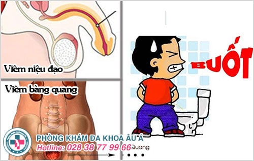 đái buốt ở nam