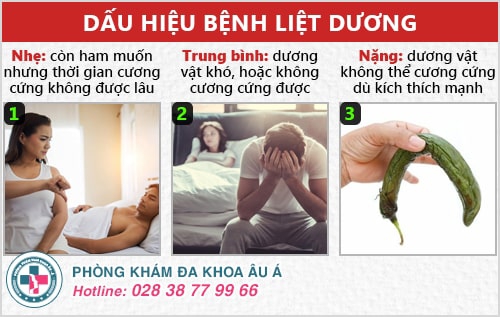 Dấu hiệu liệt dương qua các mức độ dễ nhận thấy nhất