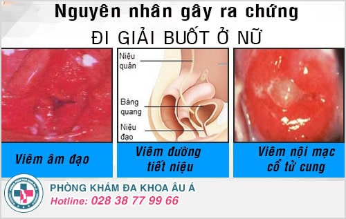đi giải buốt