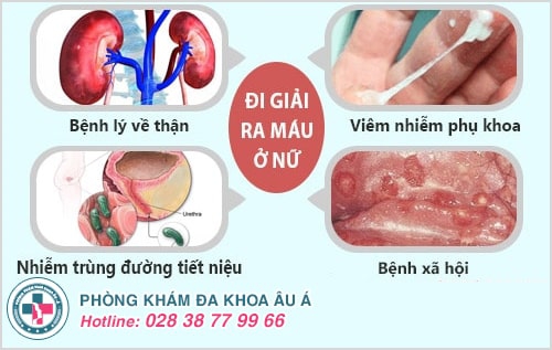 Đi giải đau, có máu là bệnh gì? Có nguy hiểm không?