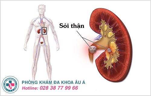 đi tiểu lâu ra