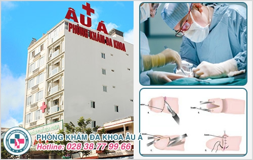 Bợn trắng bao quy đầu là bị sao? Có nguy hiểm không?