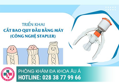 Phương pháp cắt bao quy đầu