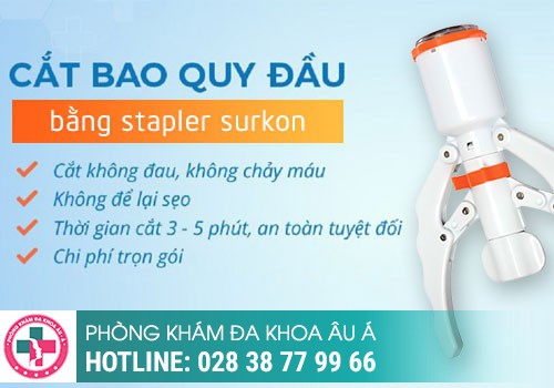 Phương pháp cắt bao quy đầu