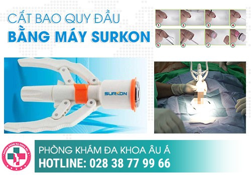 Phương pháp cắt bao quy đầu