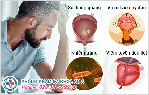 Đau nhức dương vật khiến nam giới phải dè chừng