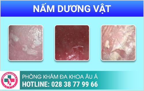 Dương vật nặng mùi