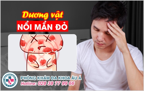 Dương vật nổi mẩn đỏ