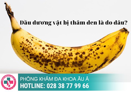 Nguyên nhân khiến dương vật bị thâm đen là do đâu?