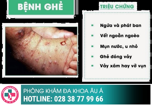 Dấu hiệu bệnh ghẻ ở bộ phận sinh dục nam