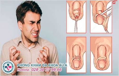 Tăng ham muốn bằng phương pháp nào hiệu quả?