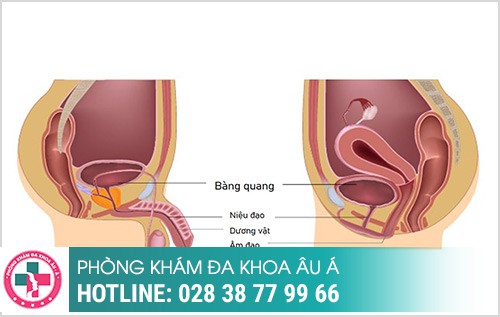 tiểu có màu đỏ, nước tiểu màu đỏ, có máu trong nước tiểu, tiểu ra nước màu đỏ