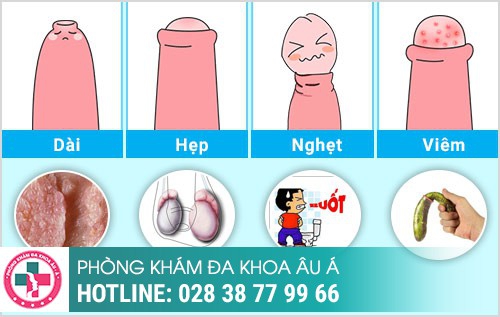 Khám dương vật ở đâu uy tín TP. HCM